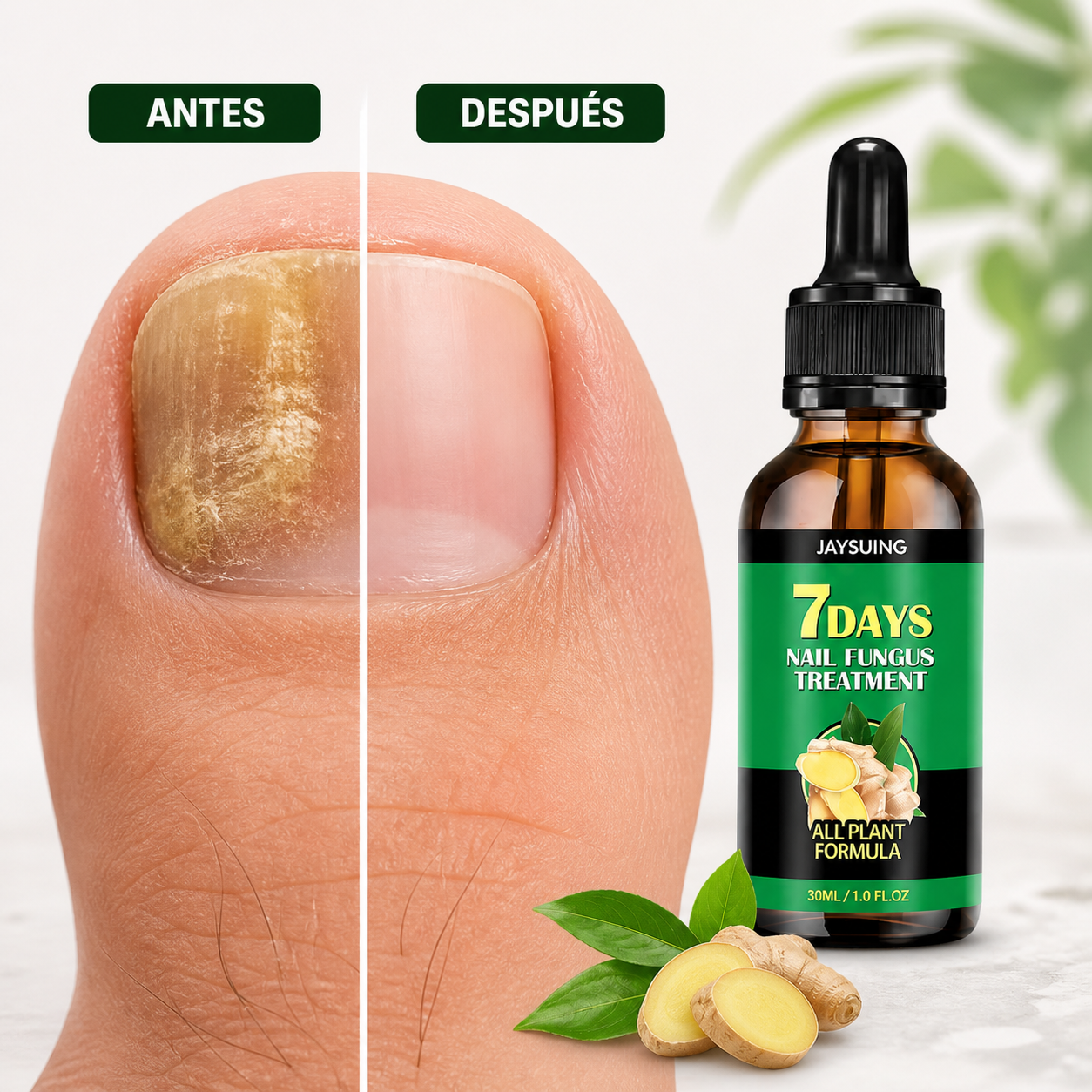 Tratamiento para Hongos en Uñas: Uñas sanas en 7 días